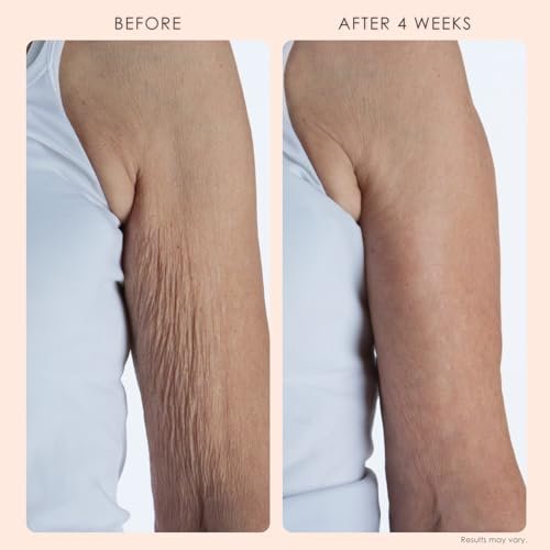 20% Off | Body Firm Crepe Erase Body Repair Treatment - Image 3