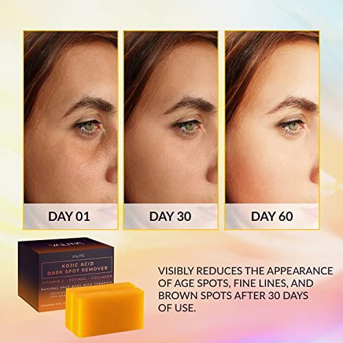 25% Off | VALITIC Kojic Acid Dark Spot Remover Soap Bars with Vitamin C, Retinol, Collagen, Turmeric - Image 2