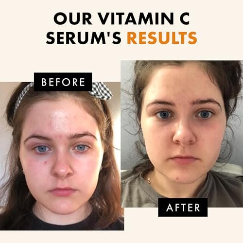 28% Off | Eclat Skincare Vitamin C Face Serum - Image 3