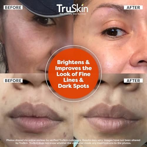 56% Off | TruSkin Vitamin C Serum For Face – Anti Aging Face Serum with Vitamin C, Hyaluronic Acid, Vitamin E - Image 4