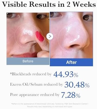 39% Off | Medicube Zero Pore Pads 2.0 - Image 5